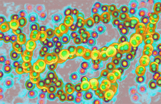 عدوى بكتيرية نادرة تتفشى باليابان.. والسلطات تكافح لتحديد سبب الانتشار صورة رقم 2 عدوى بكتيرية نادرة تتفشى باليابان.. والسلطات تكافح لتحديد سبب الانتشار صورة رقم 2