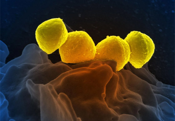 عدوى بكتيرية نادرة تتفشى باليابان.. والسلطات تكافح لتحديد سبب الانتشار صورة رقم 8 عدوى بكتيرية نادرة تتفشى باليابان.. والسلطات تكافح لتحديد سبب الانتشار صورة رقم 8