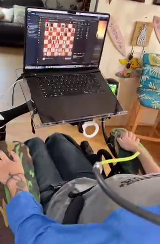 ماسك ينشر فيديو لأول إنسان خضع لزراعة شريحة بدماغه.. يتحكم بالكمبيوتر بذهنه صورة رقم 7 ماسك ينشر فيديو لأول إنسان خضع لزراعة شريحة بدماغه.. يتحكم بالكمبيوتر بذهنه صورة رقم 7