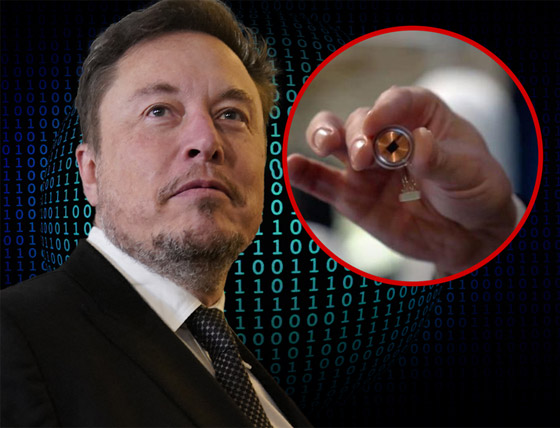 ماسك ينشر فيديو لأول إنسان خضع لزراعة شريحة بدماغه.. يتحكم بالكمبيوتر بذهنه صورة رقم 4 ماسك ينشر فيديو لأول إنسان خضع لزراعة شريحة بدماغه.. يتحكم بالكمبيوتر بذهنه صورة رقم 4