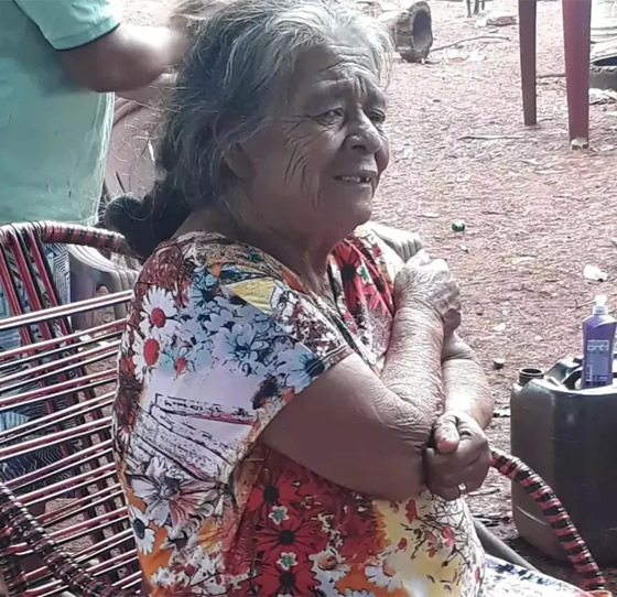 وفاة سيدة بعد عملية استئصال جنين متحجر حملته بأحشائها لأكثر من 50 سنة! صورة رقم 4