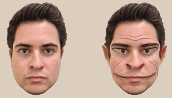 رجل مصاب بحالة نادرة وعجيبة تجعله يرى الجميع بهيئة العفاريت، ماذا قال الأطباء؟ صورة رقم 1