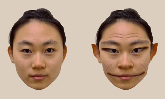 رجل مصاب بحالة نادرة وعجيبة تجعله يرى الجميع بهيئة العفاريت، ماذا قال الأطباء؟ صورة رقم 3