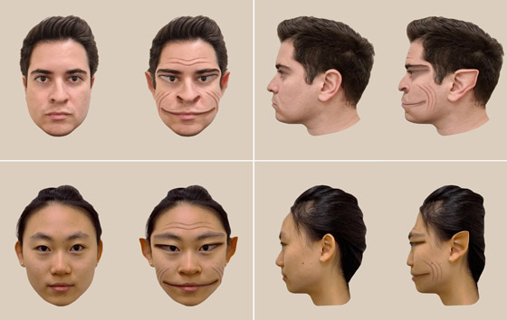 رجل مصاب بحالة نادرة وعجيبة تجعله يرى الجميع بهيئة العفاريت، ماذا قال الأطباء؟ صورة رقم 5