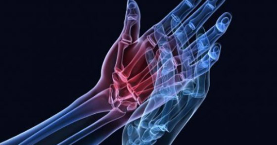 7 طرق لخفض حمض اليوريك في الجسم.. تعرف إليها صورة رقم 7