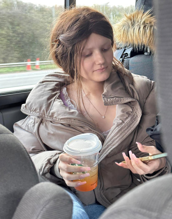 قصة نادرة لشقيقة توأم مصابة بالسرطان.. تعاني من نفس الأعراض والآلام رغم أنها بصحة جيدة! صورة رقم 6 قصة نادرة لشقيقة توأم مصابة بالسرطان.. تعاني من نفس الأعراض والآلام رغم أنها بصحة جيدة! صورة رقم 6