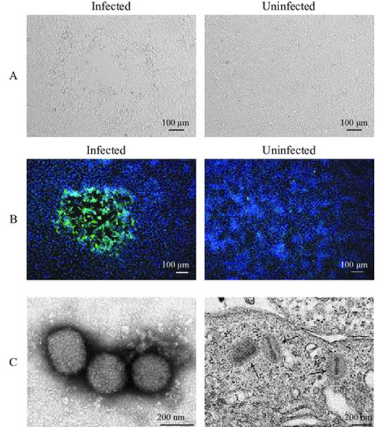 خطر وبائي.. اكتشاف سلالة متحورة من فيروس جدري القرود! صورة رقم 5