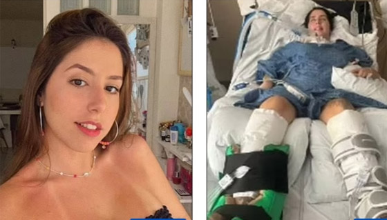 طبق حساء يصيب عشرينية بالشلل ! صورة رقم 2