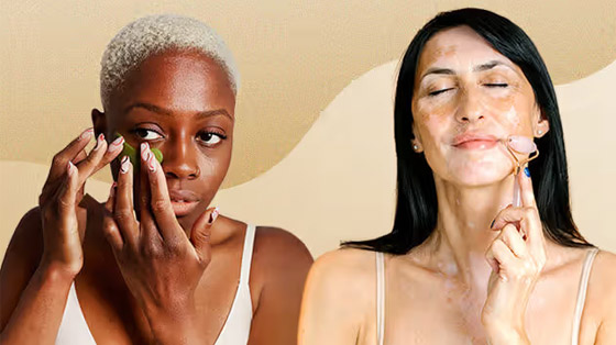 منها تناول السكر.. 7 عادات قادرة على تسريع شيخوخة البشرة صورة رقم 6