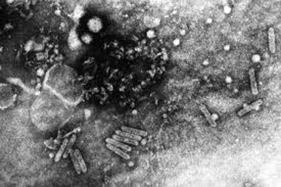 قصة فيروس سريع الانتشار يهدد وجود الشوكولاتة في العالم صورة رقم 3 قصة فيروس سريع الانتشار يهدد وجود الشوكولاتة في العالم صورة رقم 3