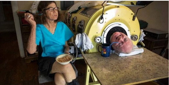 قصة ملهمة لرجل أمضى 70 عاما داخل “رئة حديدية” صورة رقم 2