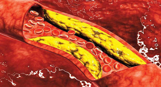 أطعمة غنية بالبروتين تساعد على خفض الكوليسترول منها الفول صورة رقم 2