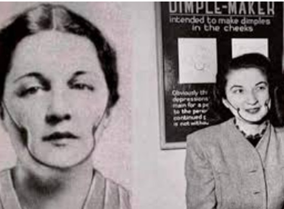 أغرب الاختراعات الطبية ربما لم تسمع بها من قبل! صورة رقم 5