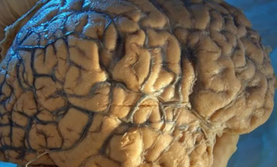 أغرب الاختراعات الطبية ربما لم تسمع بها من قبل! صورة رقم 6