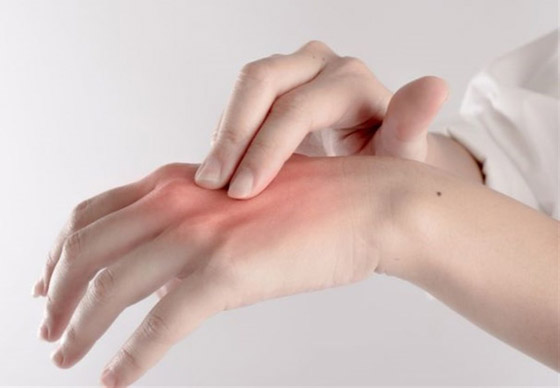 منها تغير درجات الحرارة.. 8 أسباب تؤدي إلى تورم اليدين المفاجئ صورة رقم 5