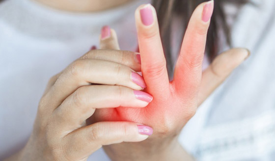 منها تغير درجات الحرارة.. 8 أسباب تؤدي إلى تورم اليدين المفاجئ صورة رقم 7