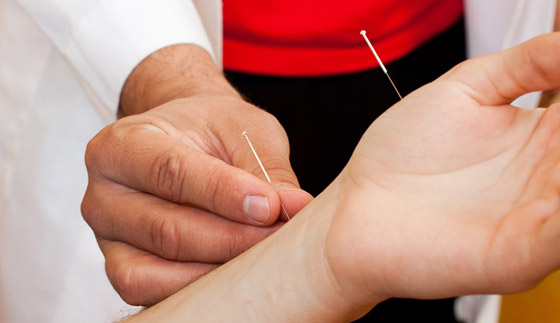 8 طرق علاجية للتخلص من زيادة التعرق صيفاً صورة رقم 2