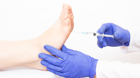 8 طرق علاجية للتخلص من زيادة التعرق صيفاً صورة رقم 4