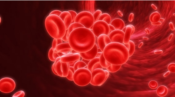 أبرز مسببات الجلطات.. عادات تمارسها يوميا اعرفها صورة رقم 2