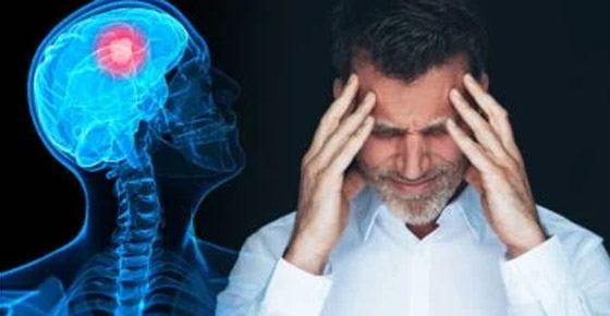 5 علامات تشير لوجود ورم في المخ قد تفاجئك.. منها التعثر أثناء المشى صورة رقم 5