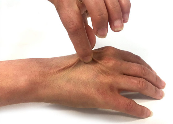 في حر الصيف.. اختبار بسيط يكشف إذا كنت تعاني من الجفاف (فيديو) صورة رقم 6