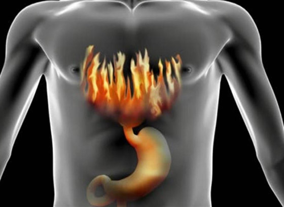 5 أطعمة توفر راحة فورية من الحموضة وحرقة المعدة صورة رقم 4