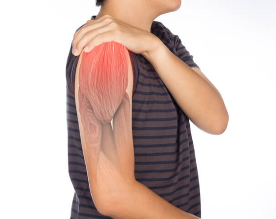 بعضها وراثي.. تعرفوا على أسباب ضعف العضلات صورة رقم 4