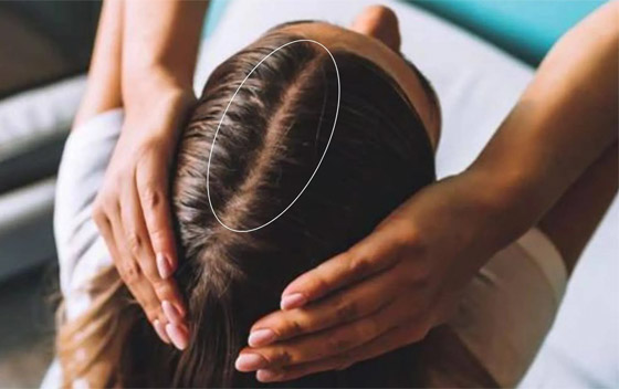 وداعا لتعرق الشعر وفروة الرأس صيفا.. أفضل حيلة بين أيديكم صورة رقم 2