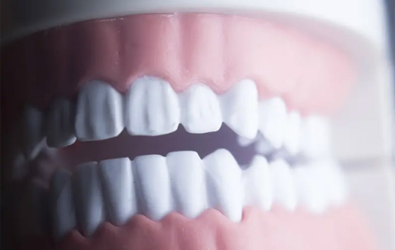 أغرب نصيحة لمنع الإصابة بتسوس الأسنان.. السر في المعجون صورة رقم 2