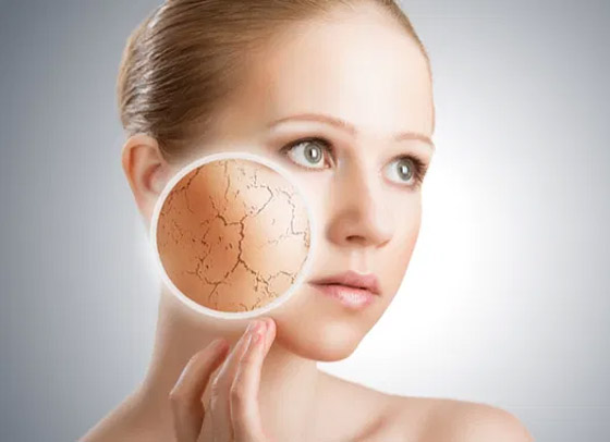 هذا ما يحدث عندما تصاب البشرة بالعطش..! صورة رقم 3 هذا ما يحدث عندما تصاب البشرة بالعطش..! صورة رقم 3