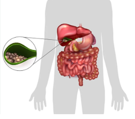  ���� ��� 3 - ����� ������ ��� ��� �������