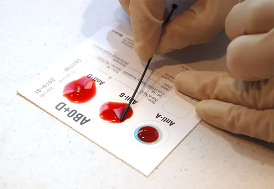 بعد غموض دام 50 عاما.. فصيلة دم جديدة تظهر صورة رقم 7 بعد غموض دام 50 عاما.. فصيلة دم جديدة تظهر صورة رقم 7