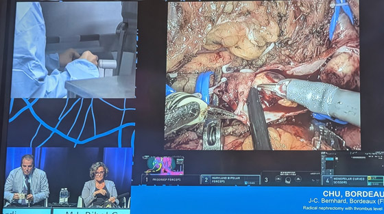 أول جراحة أول جراحة