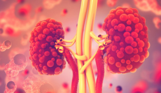 5 علامات غير عادية لتلف الكلى.. لا تتجاهلها صورة رقم 1