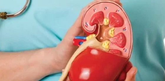 5 علامات غير عادية لتلف الكلى.. لا تتجاهلها صورة رقم 3