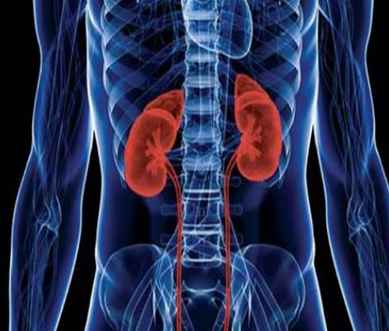 5 علامات غير عادية لتلف الكلى.. لا تتجاهلها صورة رقم 5