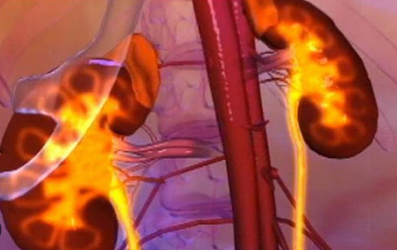 5 علامات غير عادية لتلف الكلى.. لا تتجاهلها صورة رقم 6