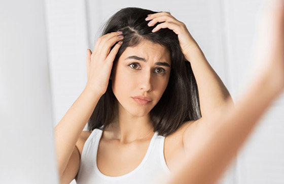 11 وصفة منزلية فعالة في القضاء نهائيا على قشرة الشعر صورة رقم 7