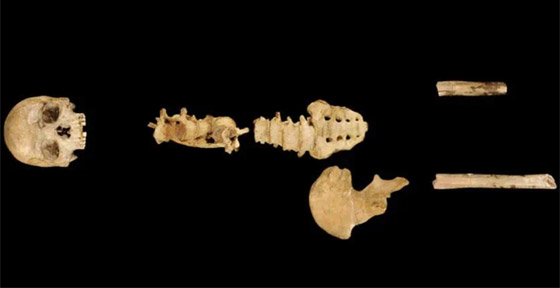 يتسمون برؤوس كبيرة.. دراسة تكتشف نوعا جديدا من البشر الأوائل صورة رقم 5