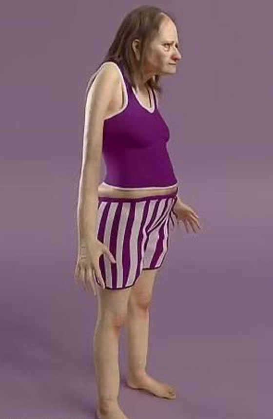 صور مرعبة.. هكذا سنبدو إذا نمنا 6 ساعات فقط! صورة رقم 5 صور مرعبة.. هكذا سنبدو إذا نمنا 6 ساعات فقط! صورة رقم 5