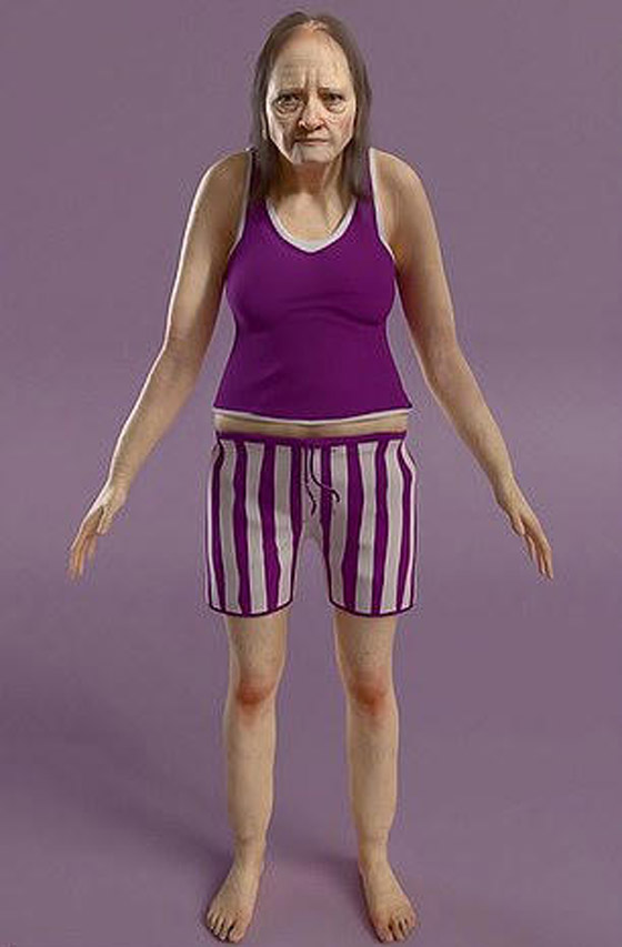 صور مرعبة.. هكذا سنبدو إذا نمنا 6 ساعات فقط! صورة رقم 7 صور مرعبة.. هكذا سنبدو إذا نمنا 6 ساعات فقط! صورة رقم 7