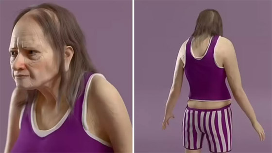 صور مرعبة.. هكذا سنبدو إذا نمنا 6 ساعات فقط! صورة رقم 4 صور مرعبة.. هكذا سنبدو إذا نمنا 6 ساعات فقط! صورة رقم 4