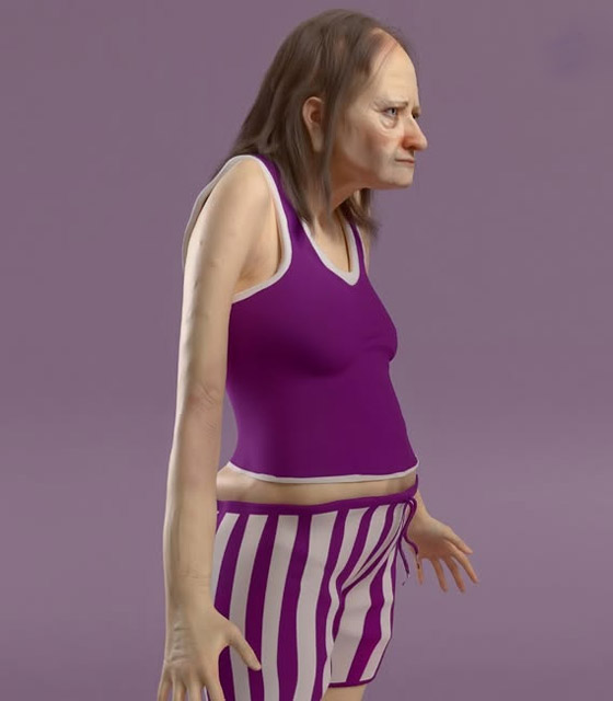 صور مرعبة.. هكذا سنبدو إذا نمنا 6 ساعات فقط! صورة رقم 2 صور مرعبة.. هكذا سنبدو إذا نمنا 6 ساعات فقط! صورة رقم 2