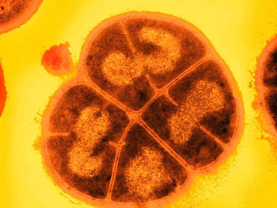 جرثومة تتحمل الإشعاع القاتل للإنسان.. والعلماء اكتشفوا سلاحها السري صورة رقم 1 جرثومة تتحمل الإشعاع القاتل للإنسان.. والعلماء اكتشفوا سلاحها السري صورة رقم 1