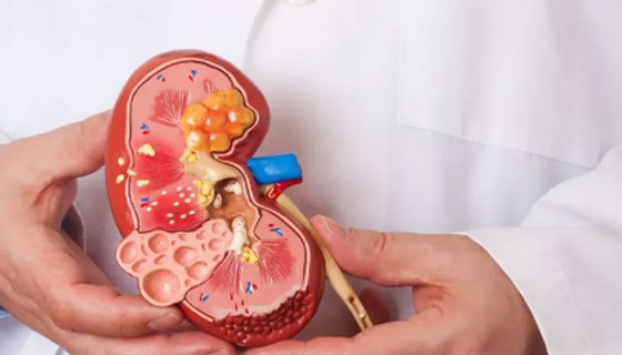 خضراوات مفيدة لصحة الكلى.. تطهرها من السموم وتحسن وظائفها صورة رقم 4