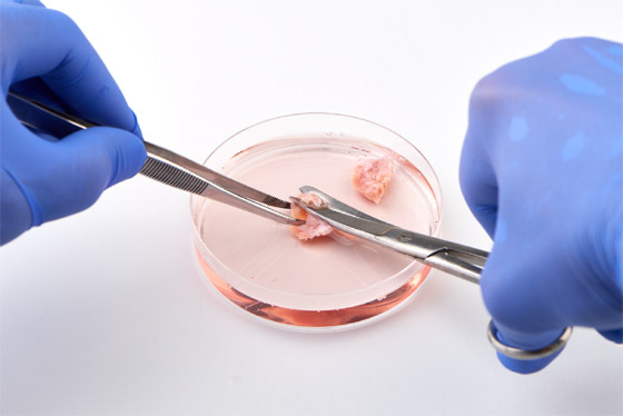 تعرفوا إلى 5 من أهم الإنجازات الطبية لعام 2024 صورة رقم 2