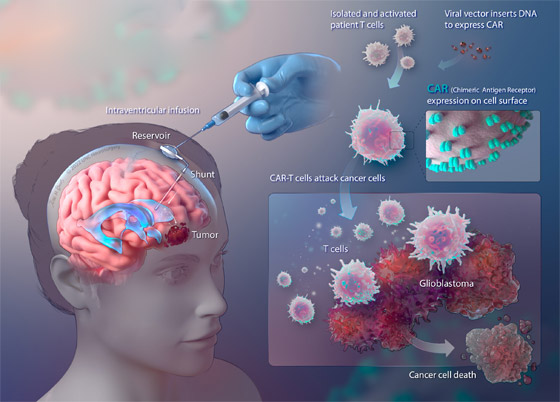 تعرفوا إلى 5 من أهم الإنجازات الطبية لعام 2024 صورة رقم 3