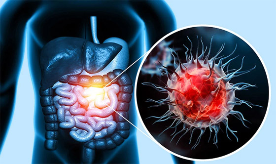 صورة رقم 6 - خبراء: 6 أنواع من السرطان فرص النجاة منها صعبة صورة رقم 6 - خبراء: 6 أنواع من السرطان فرص النجاة منها صعبة