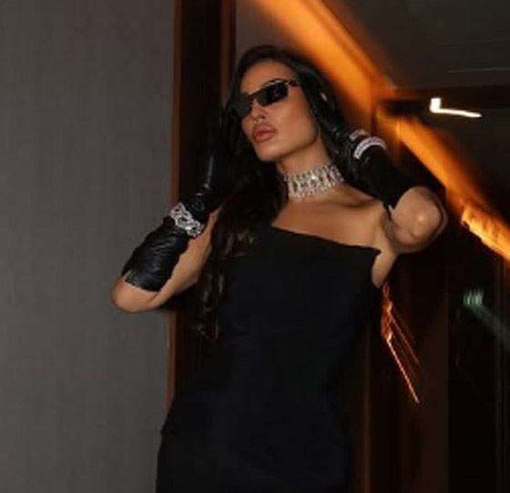 صورة قديمة لـ نادين نجيم تصدم جمهورها! شكلها مختلف تماما واتهامات بعمليات تجميل ونادين ترد: ما كنت بعرف حط ميك آب! صورة رقم 7