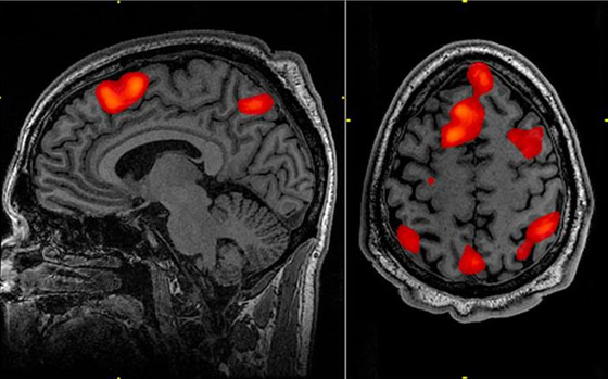 صورة رقم 5 - آخر 30 ثانية قبل مفارقة الحياة.. ماذا رأى المحتضرون العائدون من الموت؟ صورة رقم 5 - آخر 30 ثانية قبل مفارقة الحياة.. ماذا رأى المحتضرون العائدون من الموت؟